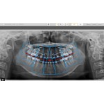 * Rayscan α-SC Ceph